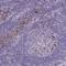 Fas Ligand antibody, HPA054959, Atlas Antibodies, Immunohistochemistry paraffin image 