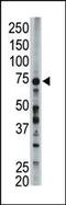 Long-chain-fatty-acid--CoA ligase 6 antibody, 61-419, ProSci, Western Blot image 