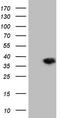 2,4-Dienoyl-CoA Reductase 1 antibody, TA808965S, Origene, Western Blot image 
