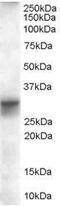 Four and a half LIM domains protein 1 antibody, GTX89636, GeneTex, Western Blot image 