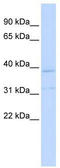 Potassium Two Pore Domain Channel Subfamily K Member 15 antibody, TA338709, Origene, Western Blot image 