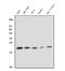 Dihydrofolate Reductase antibody, M00813-1, Boster Biological Technology, Western Blot image 