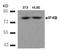 Eukaryotic translation initiation factor 4B antibody, AP09474PU-N, Origene, Western Blot image 