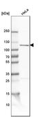 O-Linked N-Acetylglucosamine (GlcNAc) Transferase antibody, HPA030752, Atlas Antibodies, Western Blot image 