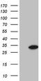 Glycine-N-Acyltransferase antibody, M09506, Boster Biological Technology, Western Blot image 