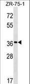 FUT5 antibody, LS-C166286, Lifespan Biosciences, Western Blot image 