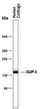 Cartilage intermediate layer protein 1 antibody, PA5-47748, Invitrogen Antibodies, Western Blot image 
