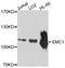ER Membrane Protein Complex Subunit 1 antibody, A11471, Boster Biological Technology, Western Blot image 