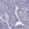 Synaptonemal Complex Central Element Protein 1 antibody, PA5-59105, Invitrogen Antibodies, Immunohistochemistry frozen image 