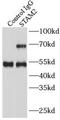 Signal Transducing Adaptor Molecule 2 antibody, FNab08284, FineTest, Immunoprecipitation image 