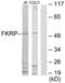 Fukutin Related Protein antibody, LS-C119270, Lifespan Biosciences, Western Blot image 