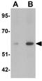 Angiopoietin 2 antibody, GTX17167, GeneTex, Western Blot image 