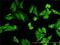 Nodal Growth Differentiation Factor antibody, H00004838-M03, Novus Biologicals, Immunocytochemistry image 