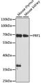Perforin 1 antibody, A0093, ABclonal Technology, Western Blot image 