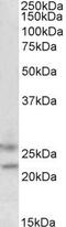F-Box Protein 44 antibody, PA5-18187, Invitrogen Antibodies, Western Blot image 