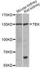 TEK Receptor Tyrosine Kinase antibody, A7222, ABclonal Technology, Western Blot image 