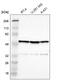 Basal Body Orientation Factor 1 antibody, HPA003136, Atlas Antibodies, Western Blot image 