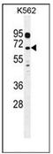Leucine Rich Repeat Containing 63 antibody, AP52544PU-N, Origene, Western Blot image 