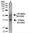 Solute Carrier Family 2 Member 2 antibody, orb377448, Biorbyt, Western Blot image 