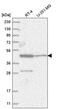 Zinc Finger Protein 586 antibody, PA5-65058, Invitrogen Antibodies, Western Blot image 