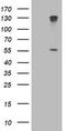 Cytochrome P450 Family 17 Subfamily A Member 1 antibody, TA503437, Origene, Western Blot image 