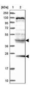 Hydroxypyruvate Isomerase (Putative) antibody, NBP1-81659, Novus Biologicals, Western Blot image 