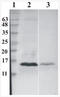 Ribonuclease 7 antibody, AM33434PU-N, Origene, Western Blot image 