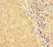 Heat Shock Protein Family A (Hsp70) Member 13 antibody, A54141-100, Epigentek, Immunohistochemistry paraffin image 