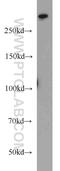 UTP20 Small Subunit Processome Component antibody, 18830-1-AP, Proteintech Group, Western Blot image 