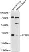 CCAAT Enhancer Binding Protein Beta antibody, 13-262, ProSci, Western Blot image 