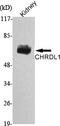 Chordin Like 1 antibody, A08014, Boster Biological Technology, Western Blot image 