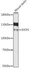 SCP1 antibody, LS-C747317, Lifespan Biosciences, Western Blot image 
