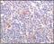 Bruton Tyrosine Kinase antibody, 32-123, ProSci, Immunohistochemistry paraffin image 