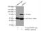 Sphingosine kinase 2 antibody, 17096-1-AP, Proteintech Group, Immunoprecipitation image 