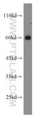 FA Complementation Group G antibody, 10215-1-AP, Proteintech Group, Western Blot image 