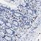 Cerberus 1, DAN Family BMP Antagonist antibody, HPA019917, Atlas Antibodies, Immunohistochemistry frozen image 