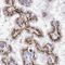 Db antibody, HPA030899, Atlas Antibodies, Immunohistochemistry paraffin image 