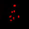 Estrogen Receptor 2 antibody, abx133103, Abbexa, Western Blot image 