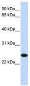Ubiquitin Conjugating Enzyme E2 K antibody, TA344493, Origene, Western Blot image 