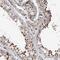 SDE2 Telomere Maintenance Homolog antibody, PA5-56690, Invitrogen Antibodies, Immunohistochemistry frozen image 