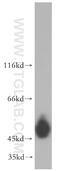 Keratin 14 antibody, 10143-1-AP, Proteintech Group, Western Blot image 