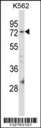 MINDY Lysine 48 Deubiquitinase 2 antibody, 57-026, ProSci, Western Blot image 
