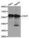 Calregulin antibody, TA326909, Origene, Western Blot image 