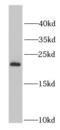 Proteasome Subunit Beta 5 antibody, FNab06874, FineTest, Western Blot image 