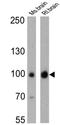 Discs Large MAGUK Scaffold Protein 4 antibody, GTX80682, GeneTex, Western Blot image 