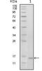 HEP antibody, GTX83050, GeneTex, Western Blot image 
