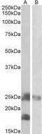 Electron transfer flavoprotein subunit alpha, mitochondrial antibody, 42-619, ProSci, Western Blot image 