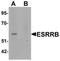 Steroid hormone receptor ERR2 antibody, TA319646, Origene, Western Blot image 
