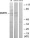 DM1 Protein Kinase antibody, TA313760, Origene, Western Blot image 