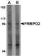 FERM And PDZ Domain Containing 2 antibody, PA5-20833, Invitrogen Antibodies, Western Blot image 